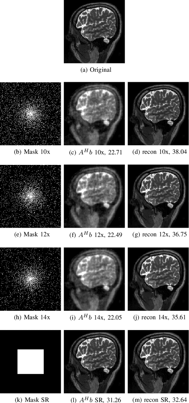 Figure 4 for MoDL: Model Based Deep Learning Architecture for Inverse Problems