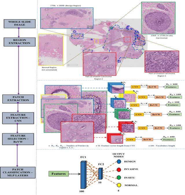 Figure 3 for Bag of Visual Words  with Deep Features -- Patch Classification Model for Limited Dataset of Breast Tumours