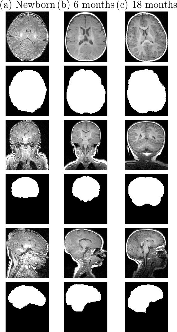 Figure 1 for Fast Infant MRI Skullstripping with Multiview 2D Convolutional Neural Networks