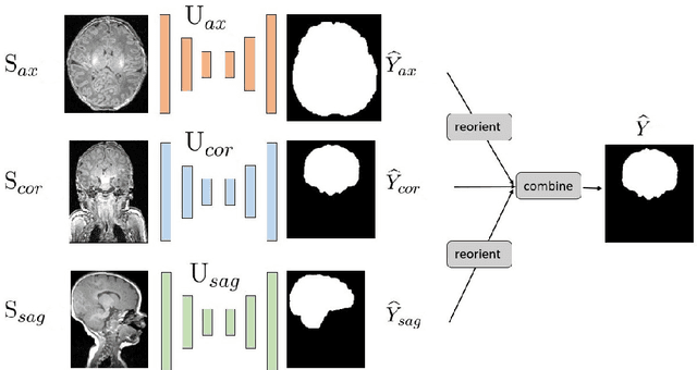Figure 4 for Fast Infant MRI Skullstripping with Multiview 2D Convolutional Neural Networks
