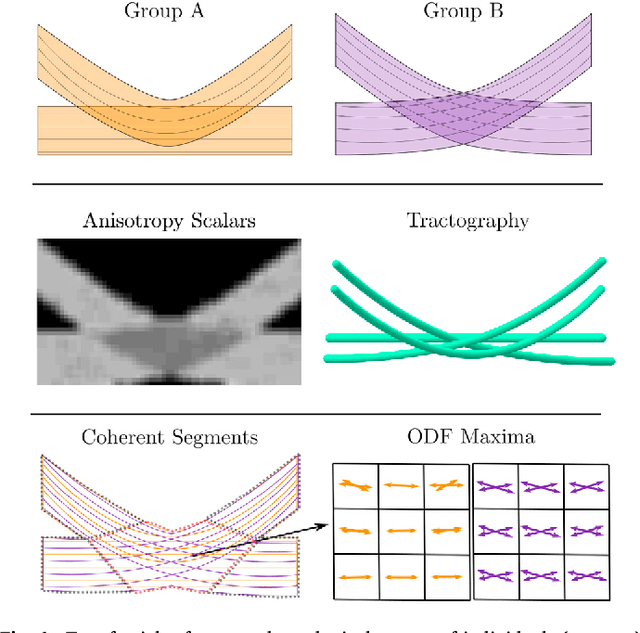 Figure 1 for Spatial Coherence of Oriented White Matter Microstructure: Applications to White Matter Regions Associated with Genetic Similarity