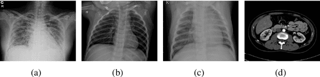 Figure 3 for Random Data Augmentation based Enhancement: A Generalized Enhancement Approach for Medical Datasets