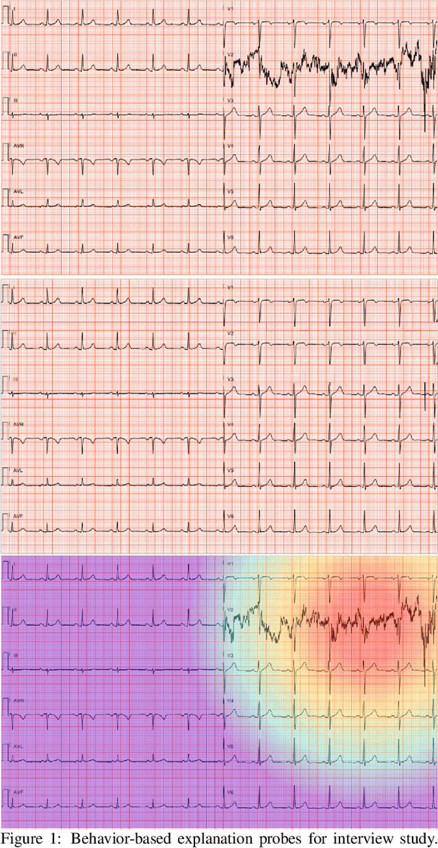 Figure 1 for Towards the Use of Saliency Maps for Explaining Low-Quality Electrocardiograms to End Users