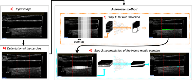 Figure 2 for Carotid artery wall segmentation in ultrasound image sequences using a deep convolutional neural network