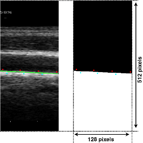 Figure 3 for Carotid artery wall segmentation in ultrasound image sequences using a deep convolutional neural network