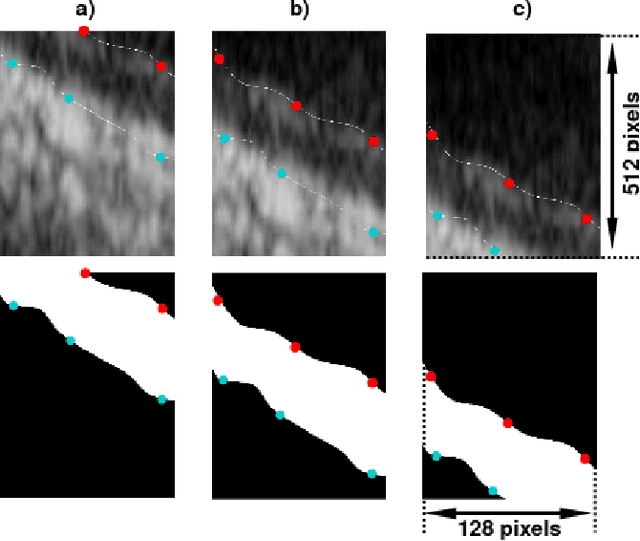 Figure 4 for Carotid artery wall segmentation in ultrasound image sequences using a deep convolutional neural network