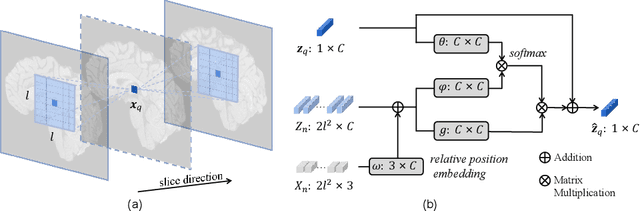 Figure 3 for Arbitrary Reduction of MRI Slice Spacing Based on Local-Aware Implicit Representation