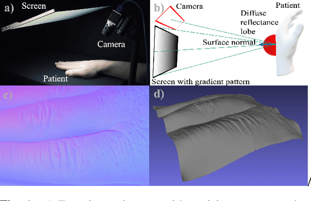 Figure 1 for SkinScan: Low-Cost 3D-Scanning for Dermatologic Diagnosis and Documentation