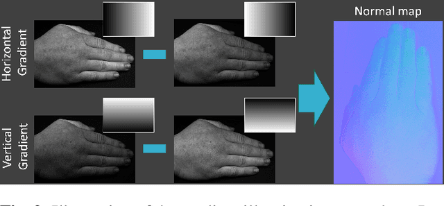 Figure 2 for SkinScan: Low-Cost 3D-Scanning for Dermatologic Diagnosis and Documentation