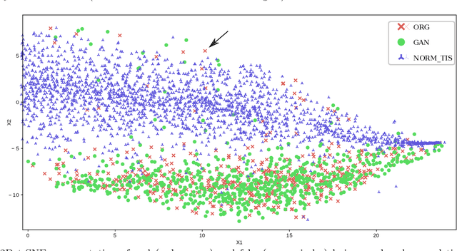 Figure 2 for Quality analysis of DCGAN-generated mammography lesions