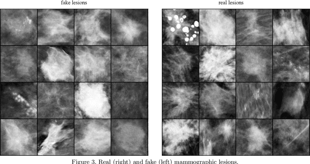 Figure 3 for Quality analysis of DCGAN-generated mammography lesions