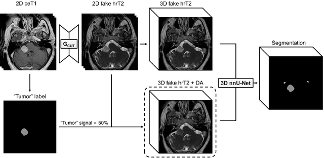 Figure 1 for Using Out-of-the-Box Frameworks for Unpaired Image Translation and Image Segmentation for the crossMoDA Challenge