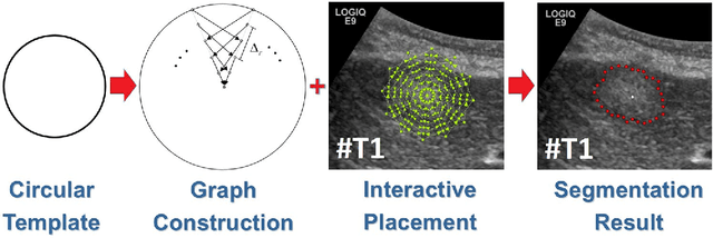 Figure 3 for Interactive Outlining of Pancreatic Cancer Liver Metastases in Ultrasound Images