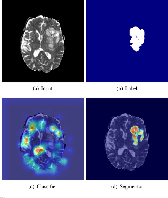 Figure 1 for Harmonizing Pathological and Normal Pixels for Pseudo-healthy Synthesis