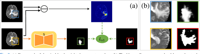 Figure 3 for Harmonizing Pathological and Normal Pixels for Pseudo-healthy Synthesis