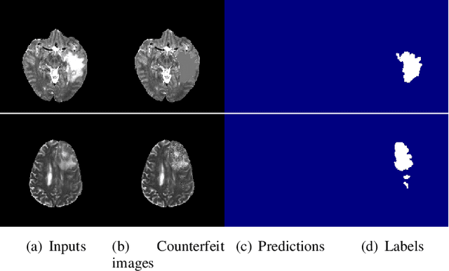 Figure 4 for Harmonizing Pathological and Normal Pixels for Pseudo-healthy Synthesis