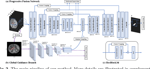 Figure 3 for Globally Guided Progressive Fusion Network for 3D Pancreas Segmentation