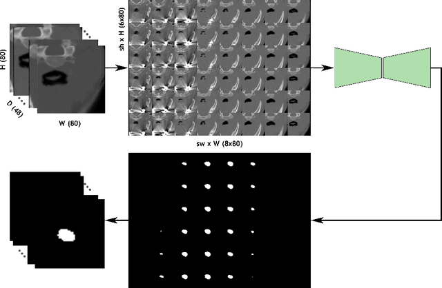 Figure 1 for Segmentation with Super Images: A New 2D Perspective on 3D Medical Image Analysis