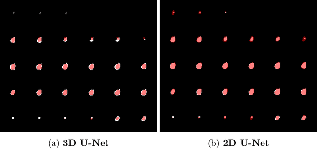 Figure 4 for Segmentation with Super Images: A New 2D Perspective on 3D Medical Image Analysis