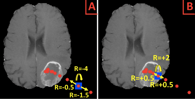 Figure 1 for Deep reinforcement learning to detect brain lesions on MRI: a proof-of-concept application of reinforcement learning to medical images