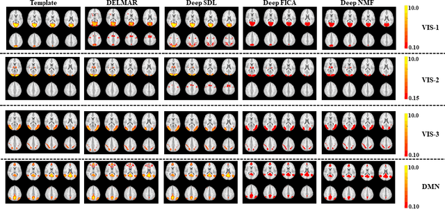 Figure 1 for DELMAR: Deep Linear Matrix Approximately Reconstruction to Extract Hierarchical Functional Connectivity in the Human Brain