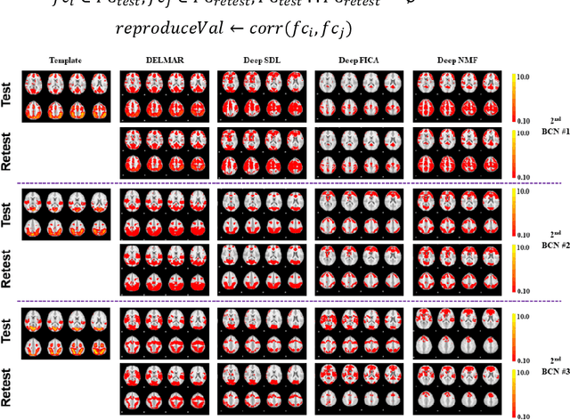 Figure 4 for DELMAR: Deep Linear Matrix Approximately Reconstruction to Extract Hierarchical Functional Connectivity in the Human Brain