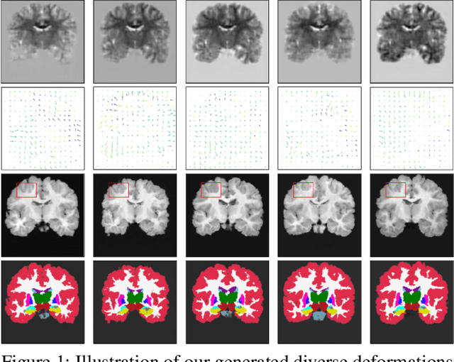 Figure 1 for Modeling the Probabilistic Distribution of Unlabeled Data forOne-shot Medical Image Segmentation