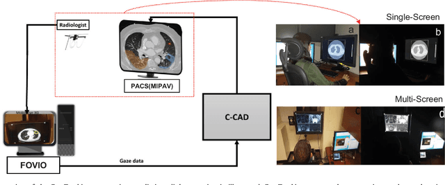 Figure 3 for A Collaborative Computer Aided Diagnosis (C-CAD) System with Eye-Tracking, Sparse Attentional Model, and Deep Learning