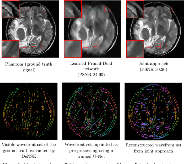 Figure 1 for Deep Microlocal Reconstruction for Limited-Angle Tomography