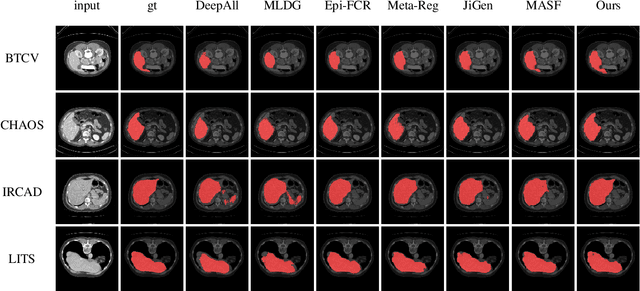 Figure 2 for Domain Generalization on Medical Imaging Classification using Episodic Training with Task Augmentation