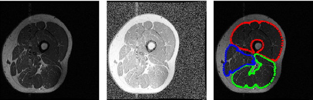 Figure 1 for Image Segmentation with Adaptive Spatial Priors from Joint Registration