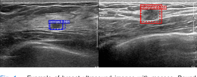 Figure 1 for Joint Weakly and Semi-Supervised Deep Learning for Localization and Classification of Masses in Breast Ultrasound Images