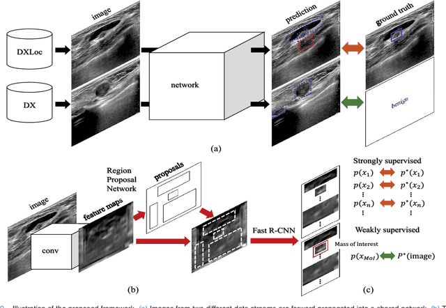 Figure 2 for Joint Weakly and Semi-Supervised Deep Learning for Localization and Classification of Masses in Breast Ultrasound Images