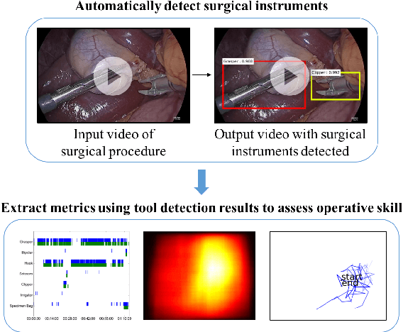 Figure 1 for Tool Detection and Operative Skill Assessment in Surgical Videos Using Region-Based Convolutional Neural Networks