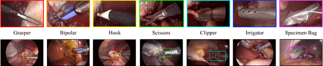 Figure 3 for Tool Detection and Operative Skill Assessment in Surgical Videos Using Region-Based Convolutional Neural Networks
