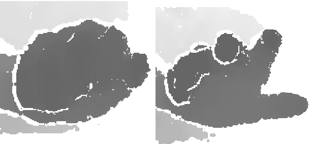 Figure 4 for Hand range of motion evaluation for Rheumatoid Arthritis patients