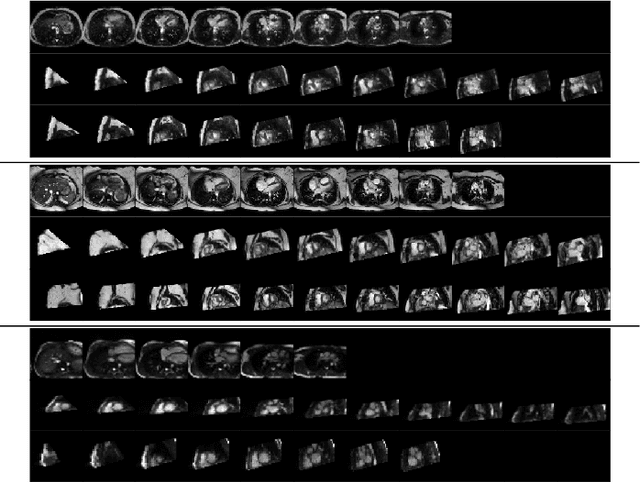 Figure 4 for Unsupervised Domain Adaptation from Axial to Short-Axis Multi-Slice Cardiac MR Images by Incorporating Pretrained Task Networks