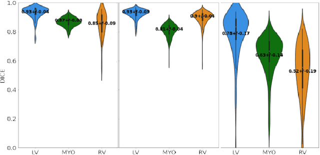 Figure 2 for Unsupervised Domain Adaptation from Axial to Short-Axis Multi-Slice Cardiac MR Images by Incorporating Pretrained Task Networks