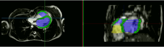 Figure 3 for Unsupervised Domain Adaptation from Axial toShort-Axis Multi-Slice Cardiac MR Images byIncorporating Pretrained Task Networks
