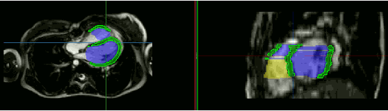 Figure 3 for Unsupervised Domain Adaptation from Axial to Short-Axis Multi-Slice Cardiac MR Images by Incorporating Pretrained Task Networks