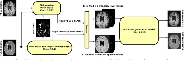 Figure 1 for Multiple Sclerosis Lesion Synthesis in MRI using an encoder-decoder U-NET