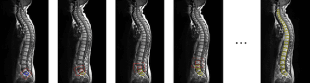 Figure 3 for The Ladder Algorithm: Finding Repetitive Structures in Medical Images by Induction