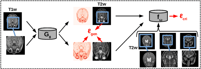 Figure 1 for Unsupervised Joint Image Transfer and Uncertainty Quantification using Patch Invariant Networks