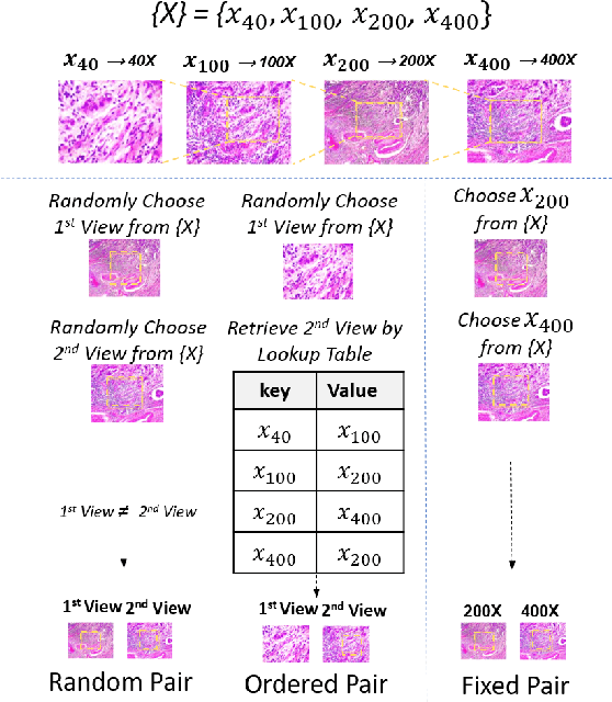 Figure 3 for Magnification Prior: A Self-Supervised Method for Learning Representations on Breast Cancer Histopathological Images