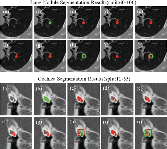 Figure 4 for Mixed-Supervised Dual-Network for Medical Image Segmentation