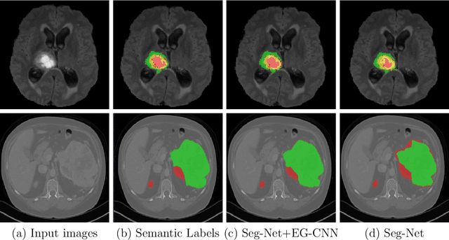 Figure 3 for Deep Learning of Unified Region, Edge, and Contour Models for Automated Image Segmentation