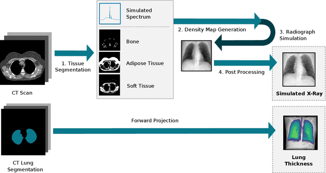 Figure 1 for Per-Pixel Lung Thickness and Lung Capacity Estimation on Chest X-Rays using Convolutional Neural Networks