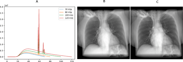 Figure 2 for Per-Pixel Lung Thickness and Lung Capacity Estimation on Chest X-Rays using Convolutional Neural Networks