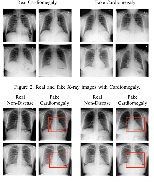 Figure 4 for Jekyll: Attacking Medical Image Diagnostics using Deep Generative Models
