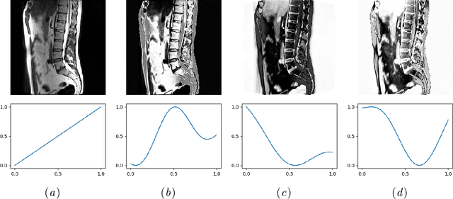 Figure 1 for Random smooth gray value transformations for cross modality learning with gray value invariant networks